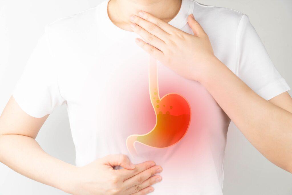 how-to-relieve-gerd-without-medication-digestive-health-services