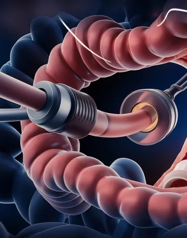 colonoscopy-technology-with-endoscope-inside-intestine-with-polyp